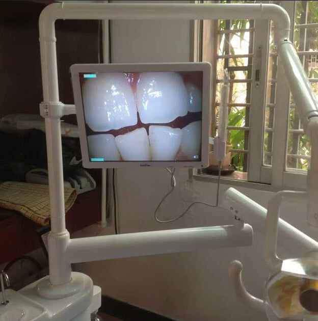 Dentista câmera intra oral oral dental usb câmera intraoral endoscópio sessão de fotos
