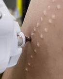 DMjet Needle-Free Injection Air Jet Beauty Machine For Acne Scar Removal Scalp Treatment