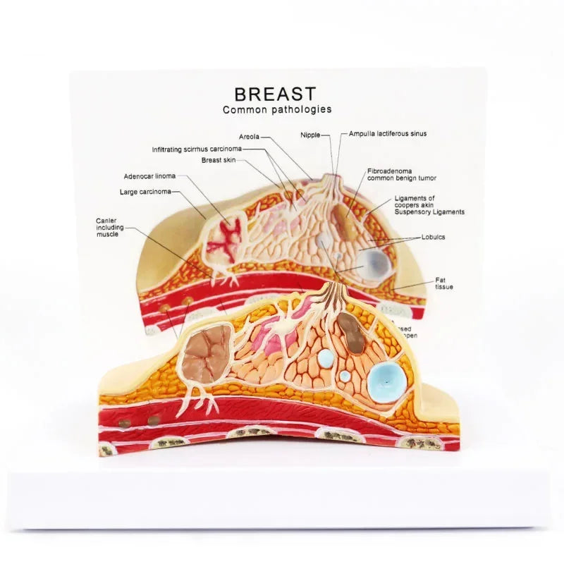 1:1 modelo de seção mediana de anatomia da mama feminina humana, kit de modelo de lesão mamária tipo mesa, seios lactantes