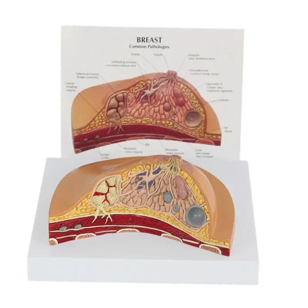 Модель среднего сечения 1:1, набор анатомических моделей патологии женской груди человека, модель поражения молочной железы настольного типа, кормящая грудь