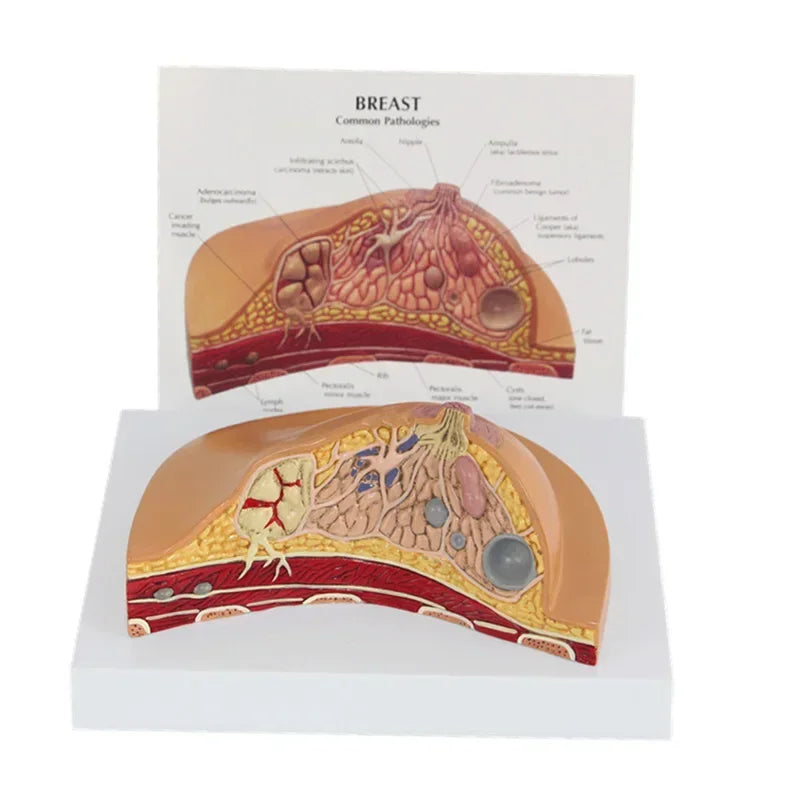 Modello di sezione mediana 1:1 del kit di modello di anatomia della patologia del seno femminile umano Kit di modello di lesione al seno di tipo tavolo seni in allattamento