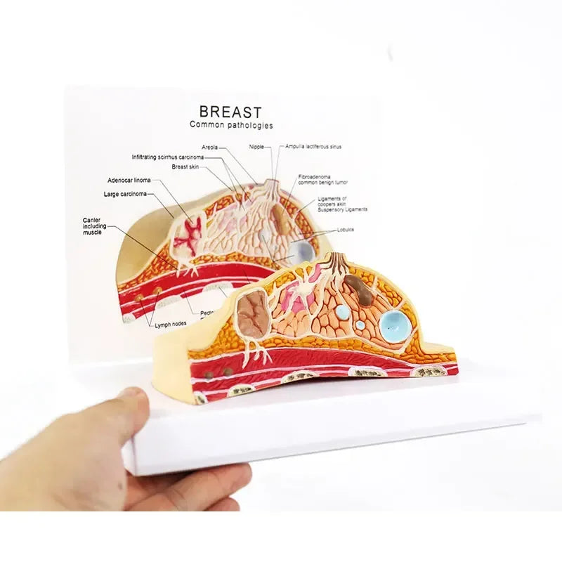Modelo de sección media 1:1 de patología mamaria humana femenina, Kit de modelo de anatomía, modelo de lesión mamaria tipo mesa, senos lactantes
