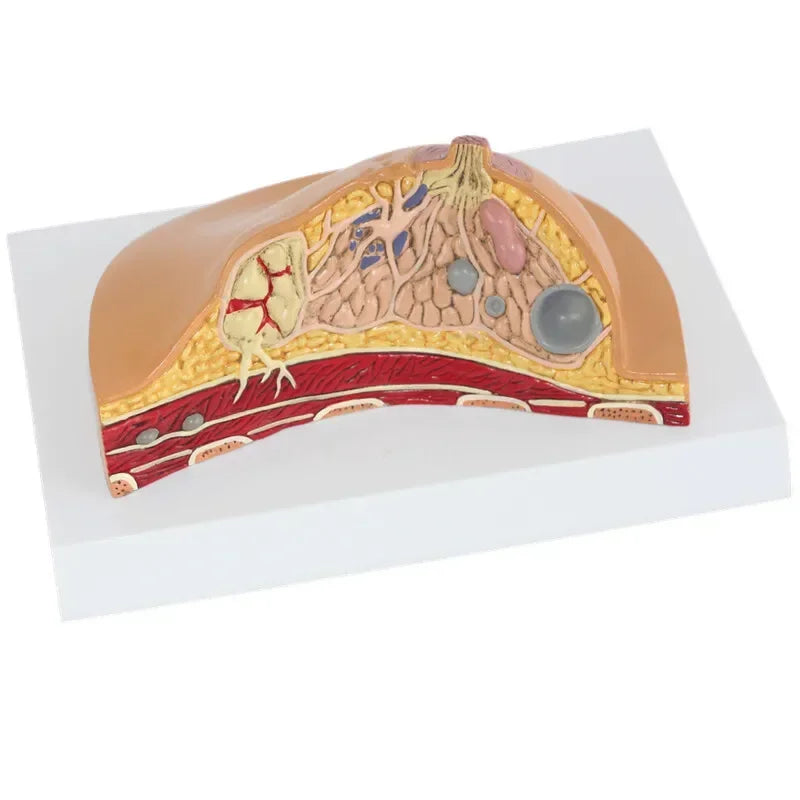 1:1 Mediaan Sectie Model van Menselijke Vrouwelijke Borst Pathologie Anatomie Model Kit Tafeltype borstlaesiemodel zogende borsten