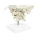 Modelo de columna Cervical humana con aumento de 1,5x, modelo de hueso occipital, ayuda para entrenamiento y enseñanza médica