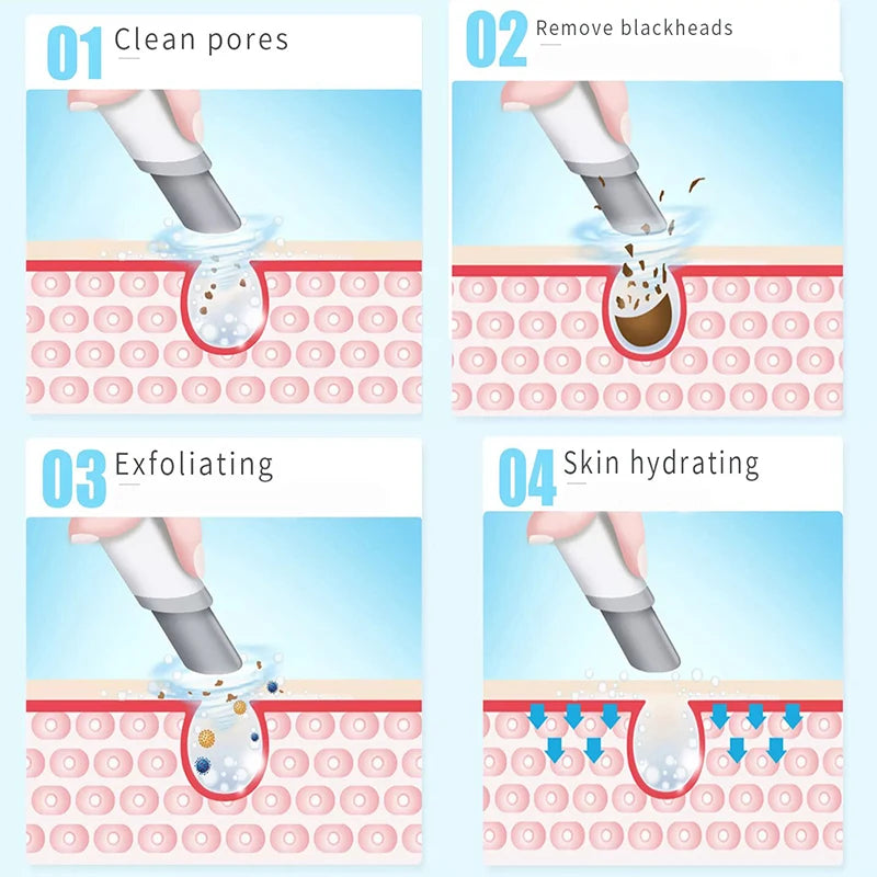 2-IN-I Hydra Dermabrasion Aqua Peeling SPA Beauty Machine Facial Hydration Sprayer Water Injection Vacuum Blackhead Face Clean