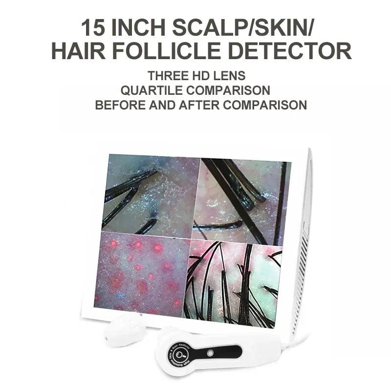 Цифровой HD-анализатор кожи, профессиональная камера для волос, кожи головы, детектор, устройство для измерения влажности масла волосяного фолликула, 15-дюймовый тестер кожи