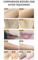 2024 professionell Alexandrite Laser 2500W 755nm 808nm 1064nm Diod Laser Epilation Portable Laser Hårborttagningsmaskin