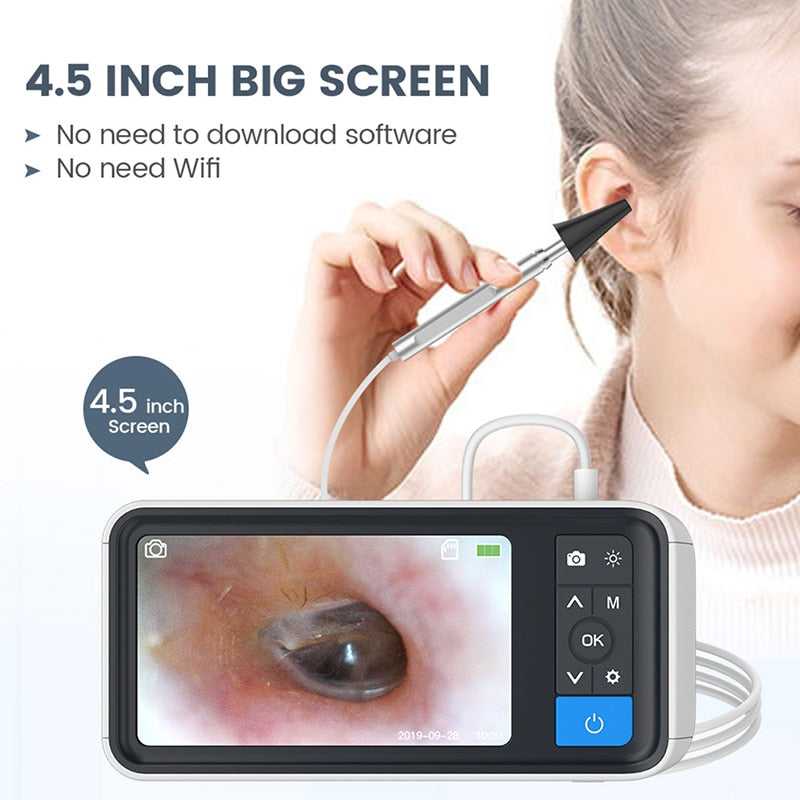 TESLONG MS450 3.9mm USB Otoscope with 4.5  Inch Display Ear Inspection Camera Ear Scope with 6 LEDs 1.0MP HD Ear Endoscope With 2500AMH