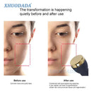 3-i-1 ultraljudsborttagning av ansiktsmaskiner för att ta bort fläckar mot åldrande högfrekvent mikroplasma freckle-borttagningspenna Skönhetsanordning