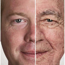 Przenośna maszyna do usuwania zmarszczek Dot Matrix RF Thermage Beauty do liftingu i napinania twarzy