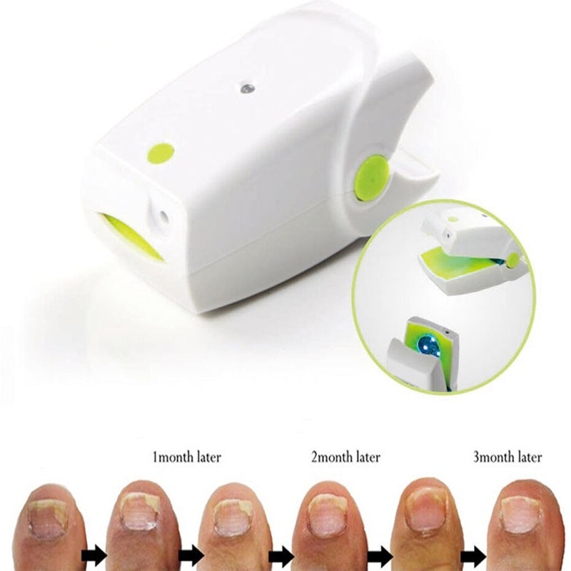 Високоефективний акумуляторний лазерний прилад для лікування грибків нігтів Інфекція нігтів про Лікує грибкові захворювання нігтів