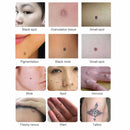 Elektronikus Tattoo anyajegy eltávolítás plazma Pen Laser Arc Freckle sötét folt eltávolító szemölcs eltávolítás Machine Face Skin Care Szépség Device