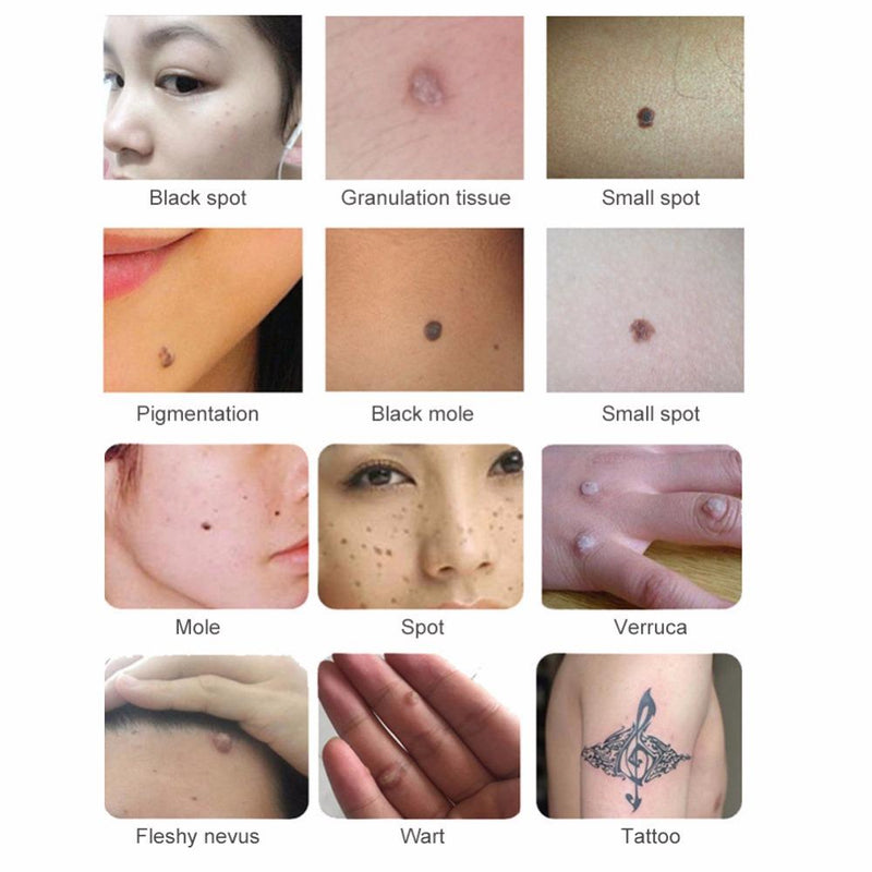 Elettronica rimozione del tatuaggio Mole rimozione Plasma Laser Pen viso Freckle macchia scura di rimozione verruca macchina pelle del fronte del dispositivo di cura di bellezza