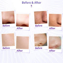 3 W 1 Diamentowe Mikrodermabrazja Dermabrazja Maszyna do usuwania zaskórnika W / Vacuum & Spray do pielęgnacji skóry Strona główna Użyj urządzenia