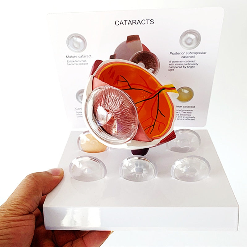 Modelo de ensino de anatomia de catarata ocular em PVC humano 4X
