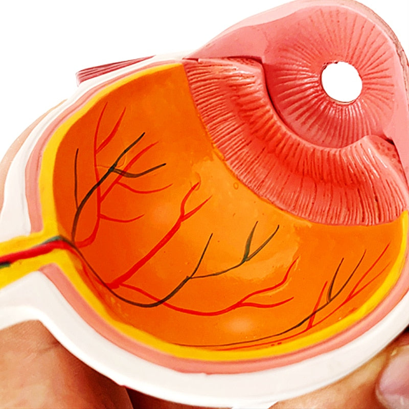 Modelo de ensino de anatomia de catarata ocular em PVC humano 4X