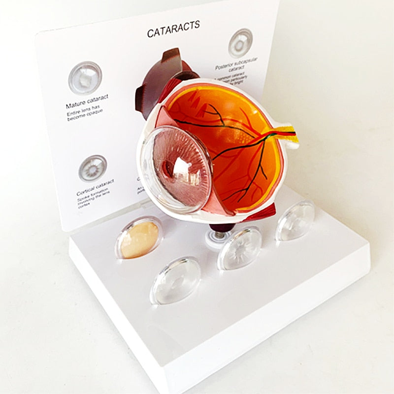 Modelo de enseñanza de anatomía de catarata de ojo humano de PVC 4X