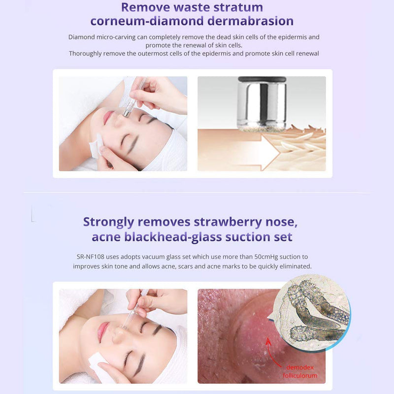 3 in 1 Diamond Microdermabrasion Dermabrasion Blackhead Removal Machine w/Vacuum & Spray for Skin Care Home Use Device