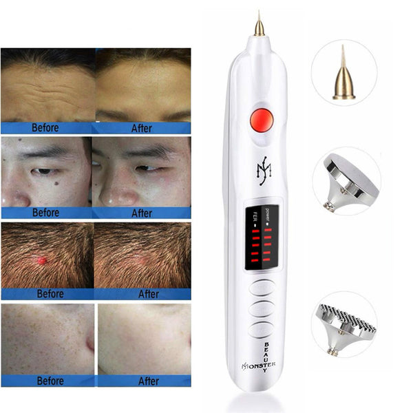 Caneta de Plasma Micro Plexr Elevador de Pálpebras Sardas Acne Marca de Pele Removedor de Manchas Escuras para Máquina de Remoção de Tatuagens Faciais Terapia de Picosegundos