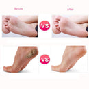 Elektrische Eelt Remover Elektronische Voet Bestand Harde Dode huid Polijstmachine Exfoliërende Slijpen Voeten Clean Care Tools Gladde Machine