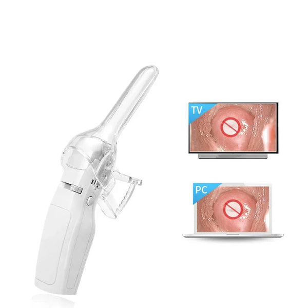 Fa2 vídeo digital eletrônico mini colposcópio hospitais colo do útero vagina examinar máquina mulheres doenças ginecológicas auto-exame