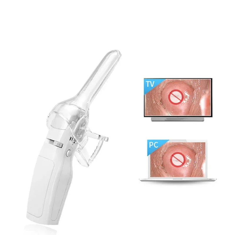 FA2 – Mini Colposcope électronique vidéo numérique, Machine d'examen du vagin et du col de l'utérus pour femmes, auto-examen des maladies gynécologiques