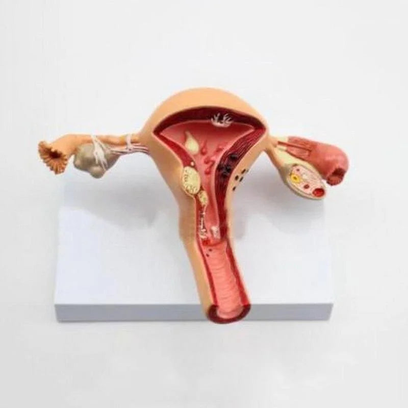 Anatomisk patologisk uterus Ovariemodell Anatomi Medicinsk organmodell Tvärsnittsstudieverktyg