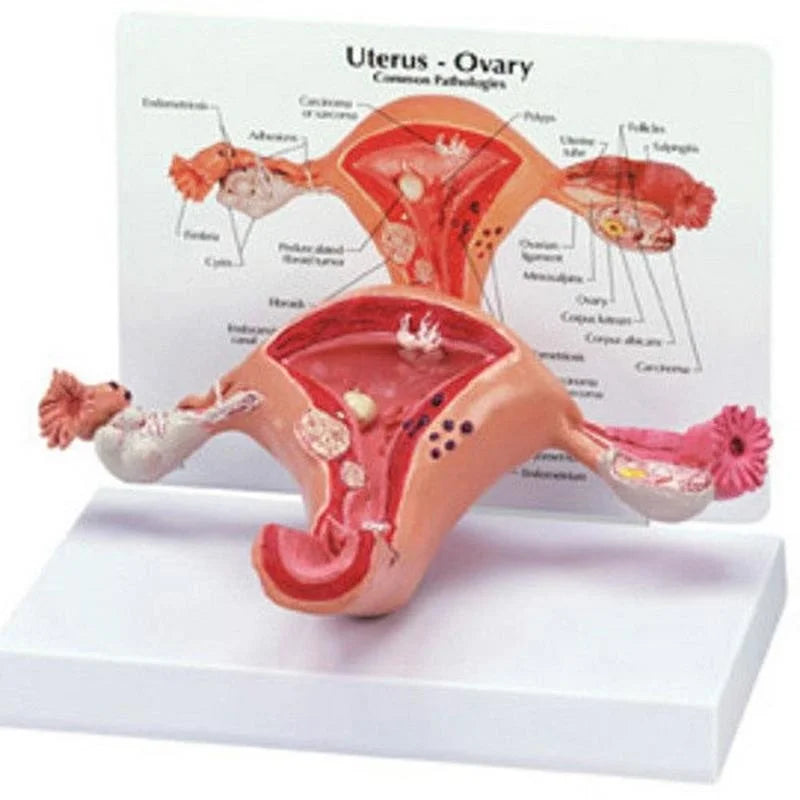 Alat Studi Penampang Model Organ Medis Anatomi Model Ovarium Rahim Patologis