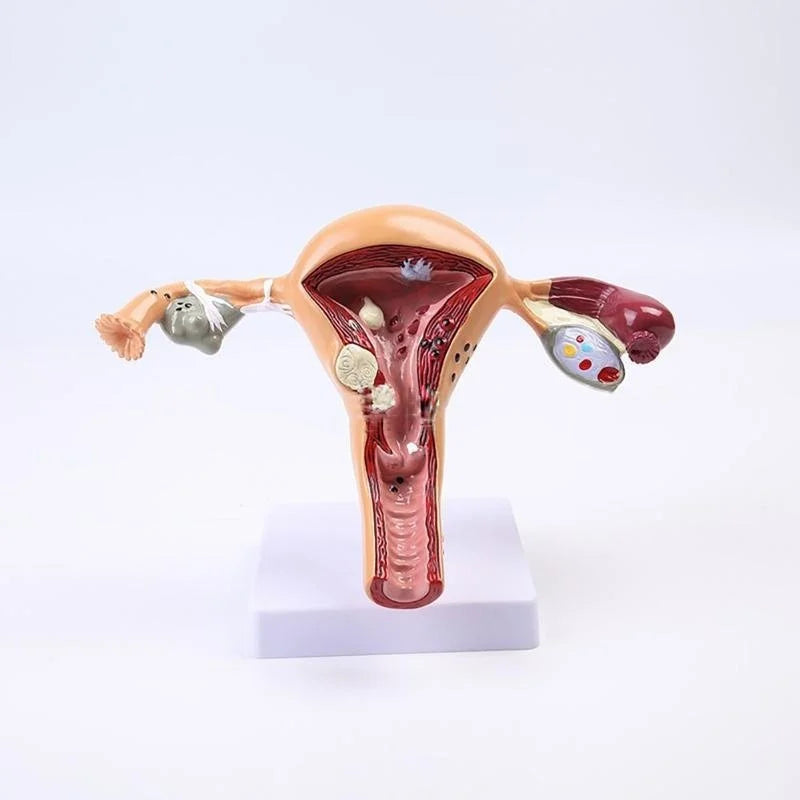 해부학 병리학 자궁 난소 모델 해부학 의료 기관 모델 단면 연구 도구