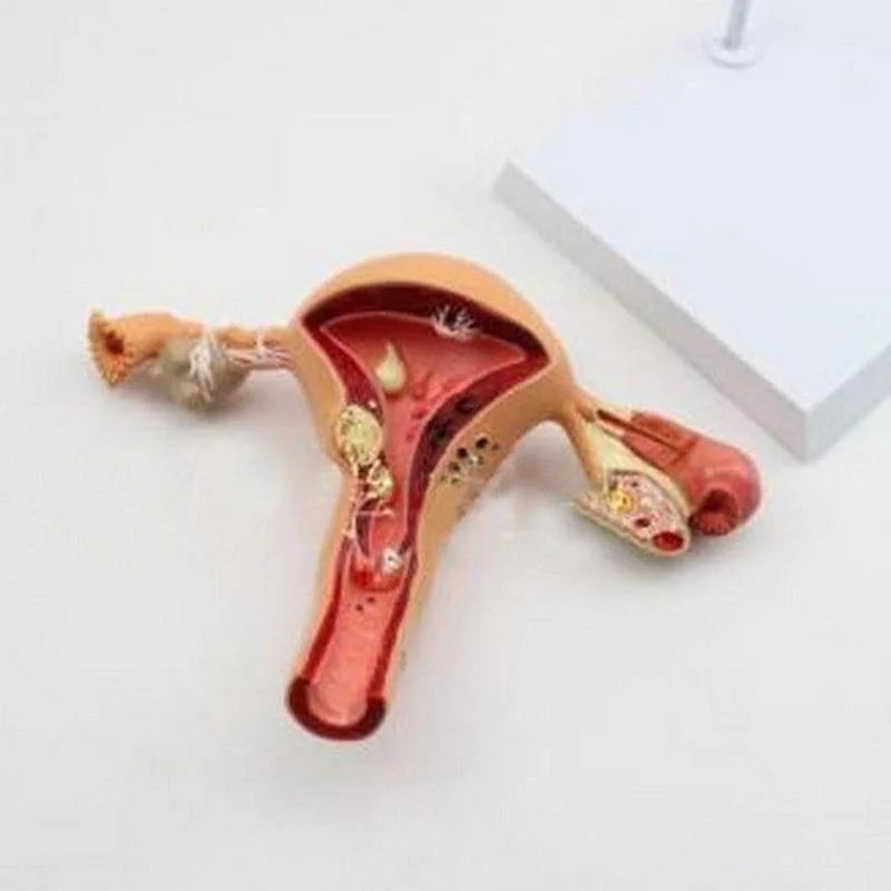 Anatomical Pathological Uterus Ovary Model Anatomy Medical Organ Model Cross Section Study Tool