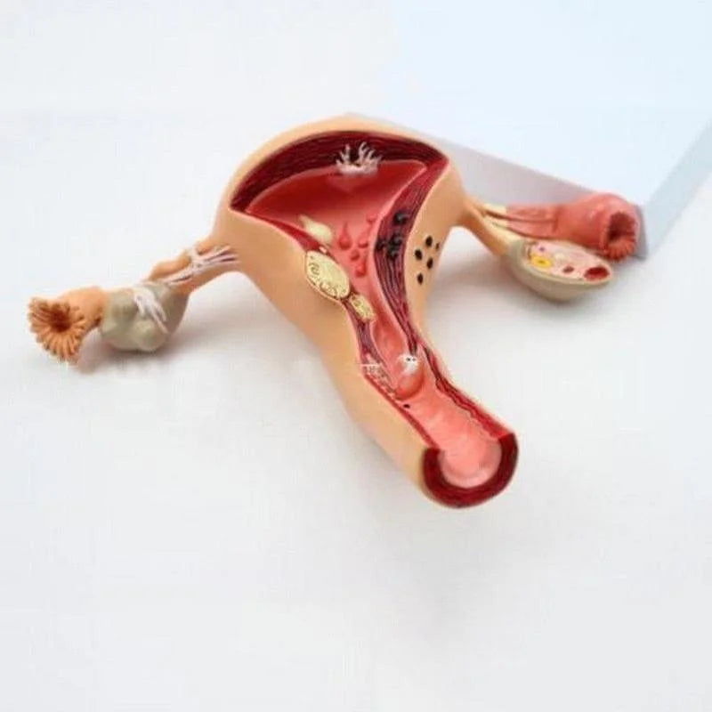 해부학 병리학 자궁 난소 모델 해부학 의료 기관 모델 단면 연구 도구