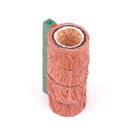 혈관 동맥 경화 모델의 인간 경화 인간 해부학 해부 모델 의료 교육 용품 도구