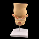 מותג חדש אנטומי אנושי פתולוגיה פי הטבעת מודל נגע טחורים פי הטבעת ציוד הוראה רפואי