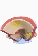 מותג חדש אנטומי אנושי פתולוגיה פי הטבעת מודל נגע טחורים פי הטבעת ציוד הוראה רפואי