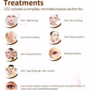Co2 Fractional Machine Co2 Fractional Laser For Wrinkle Removal and Acne Scar Removal Vagina Tighting Pigment Removal Skin Resurfacing Machine