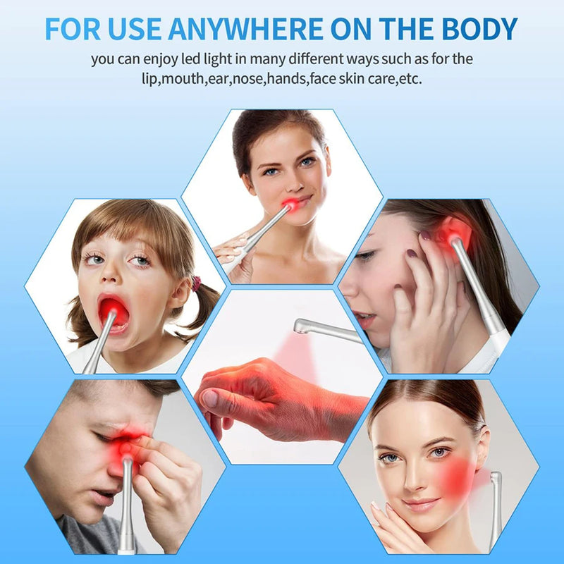 Cold Sore Laser Therapy Device Light Therapy Mouth Ulceration Blisters Herpes Infection Pain Relief Ulcer Medical Laser Care2023