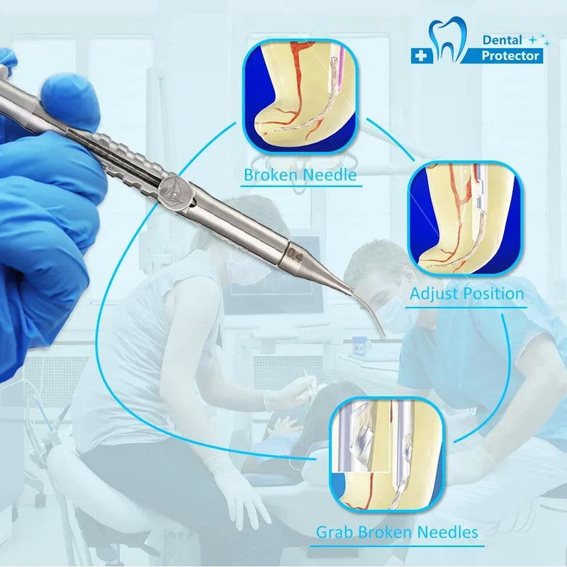 Стоматологический инструмент для удаления сломанных корневых каналов, стоматология, эндовосстановление, набор стоматологических инструментов для удаления сломанных эндофайлов