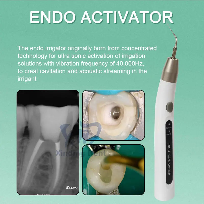 Pengaktif Ultrasonik LED Tanpa Kord Pergigian Wireless Endo Ultra Activator Untuk Alat Pergigian Pengairan Saluran Akar Endodontik