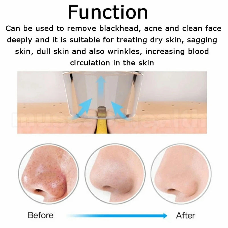 Diamond Microdermabrasion Machine Remove Blackhead Wrinkle Facial Peeling Beauty Devices Suction Power Professional Dermabrasion