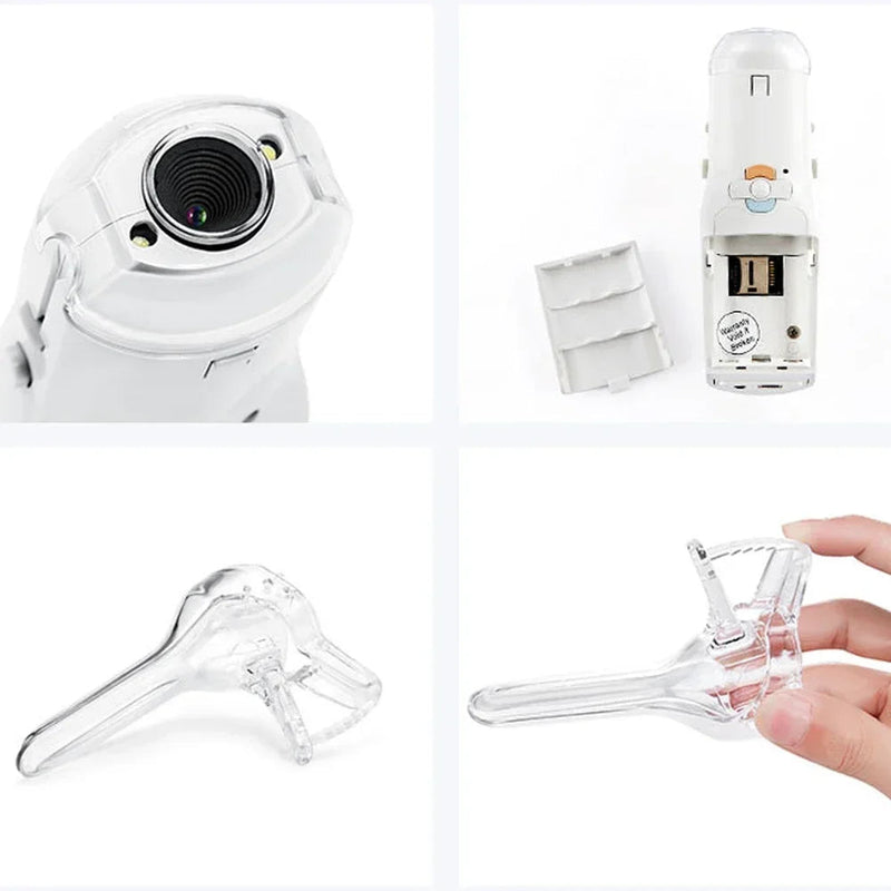 FA2 디지털 비디오 전자 미니 Colpscope 병원 자궁경부 질 검사 기계 여성 부인과 질환 자가 검사