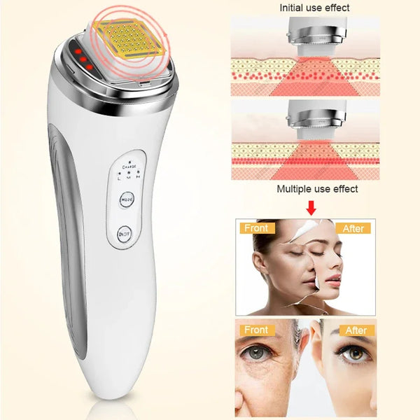 Facial Lifting Machine RF Radio Frequency Skin Tightening Rejuvenation Wrinkle Removal Dot Matrix Facial Massager Beauty Health