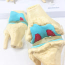 4단계 인간 병리학적 무릎 관절 해부학 모델 의학 과학 교육 자료