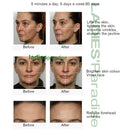 Galvanisches Strom-Elektroporator-Gerät, Hautstraffung, Facelift, Mikrostrom-Maschine, Anti-Aging-Faltenentfernungsgerät