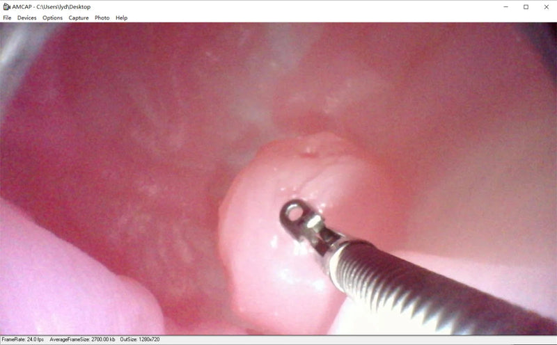 Gastroscopic surgery training model High simulation simulated stomach model ercp Gastroscope training