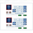 ED shockwave therapy