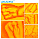 HD Vein imaging Vein Viewer Vein Finder Vein Camera Auxiliary Positioning Vein Tool