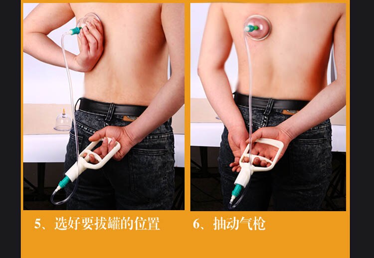 24 tunes tanques chineses de vácuo de vácuo conjuntos magnéticos hijama terapia corpo relaxar massageador para cuidados de saúde