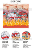 shockwave therapy machine