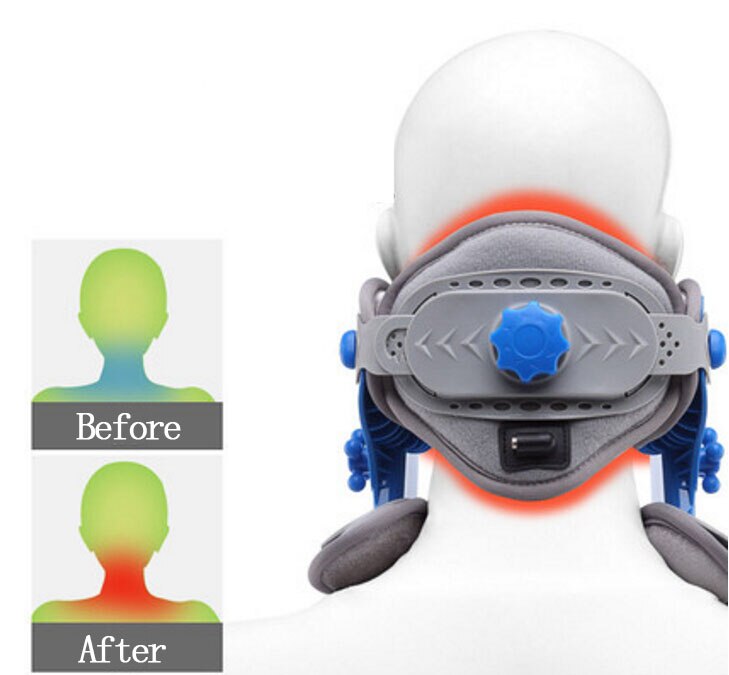 Neck Fix Neck collar correction repair neck cervical traction apparatus moxibus