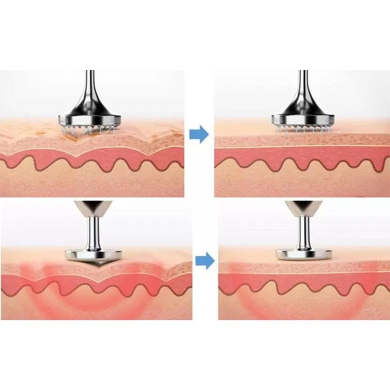 Micro Plexr Plasma Pen Kelopak Mata Mengangkat Freckles Jerawat Tag Kulit Penghilang Tompok Gelap untuk Mesin Penyingkiran Tatu Muka Terapi Picosecond